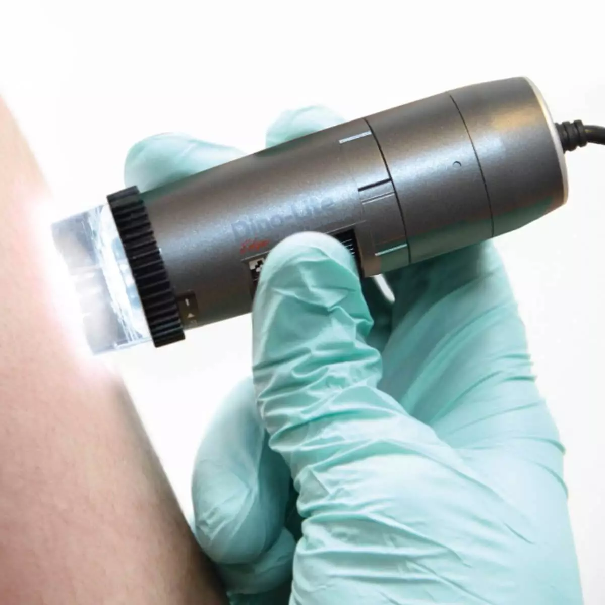 فحص البشرة بالديرموسكوب